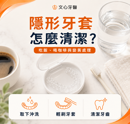 隱形牙套怎麼清潔？吃飯、喝咖啡與牙套變黃的處理重點
