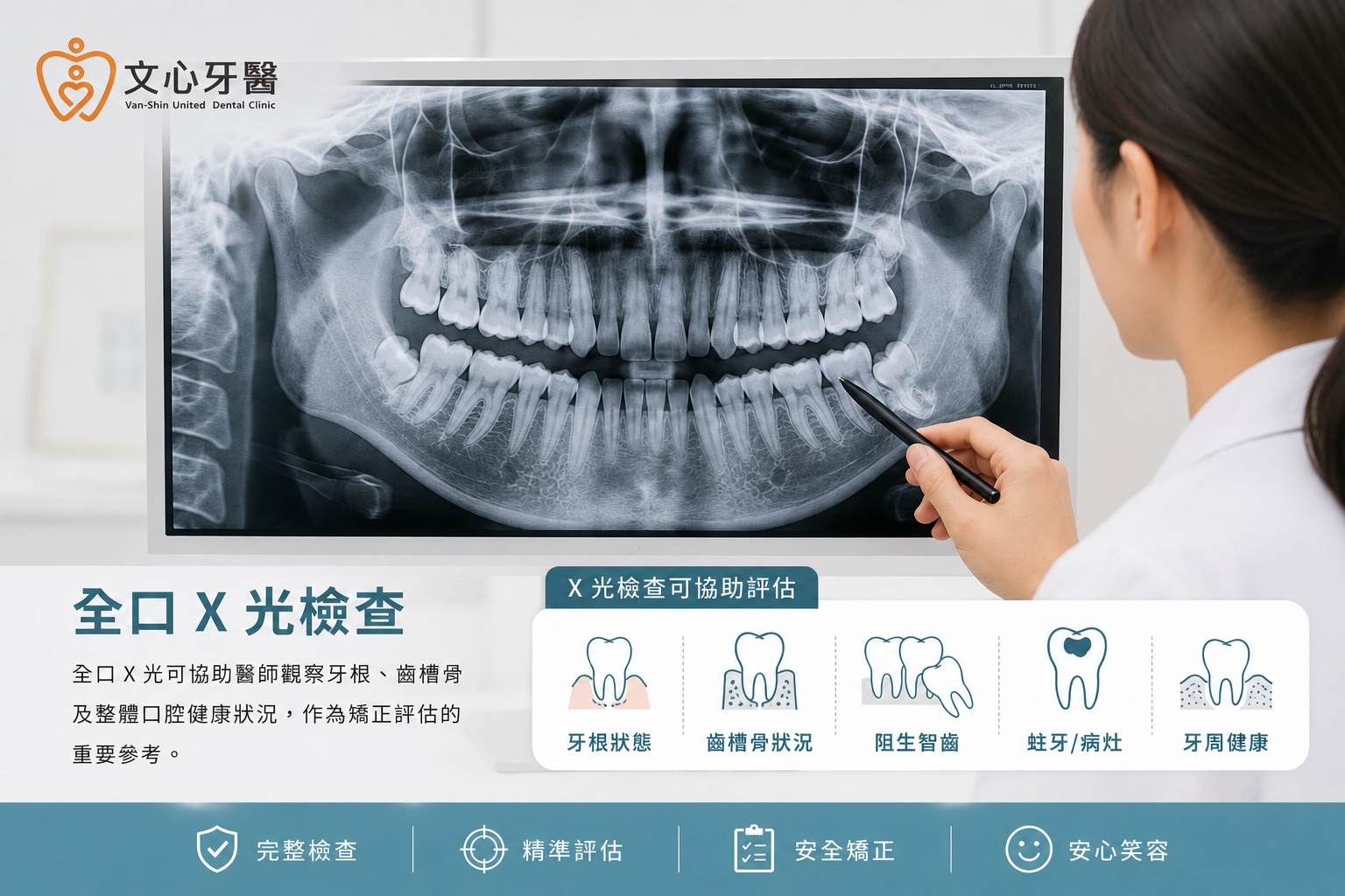 全口X光檢查示意