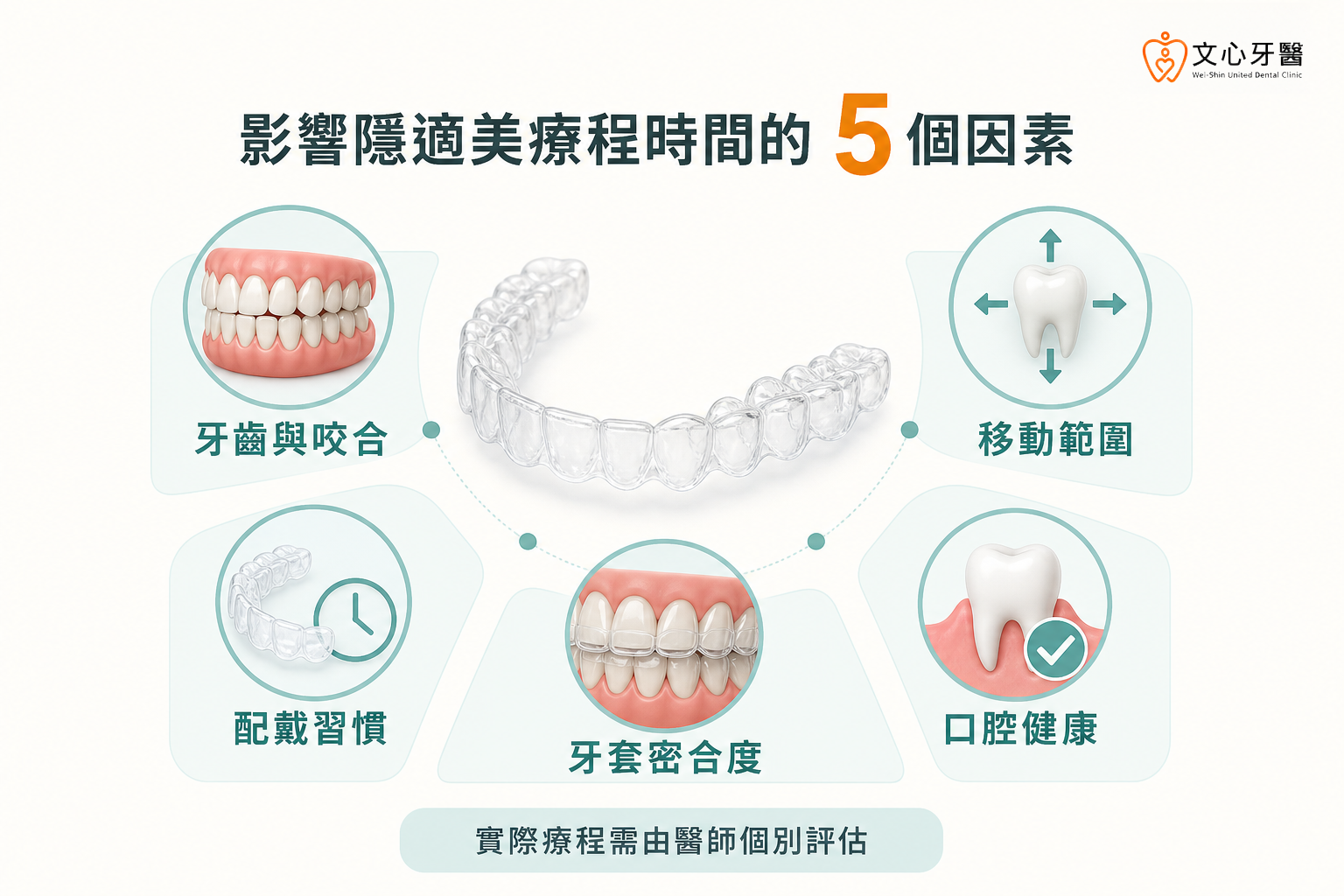 牙齒咬合、移動範圍、配戴習慣、牙套密合度與口腔健康影響隱適美療程時間