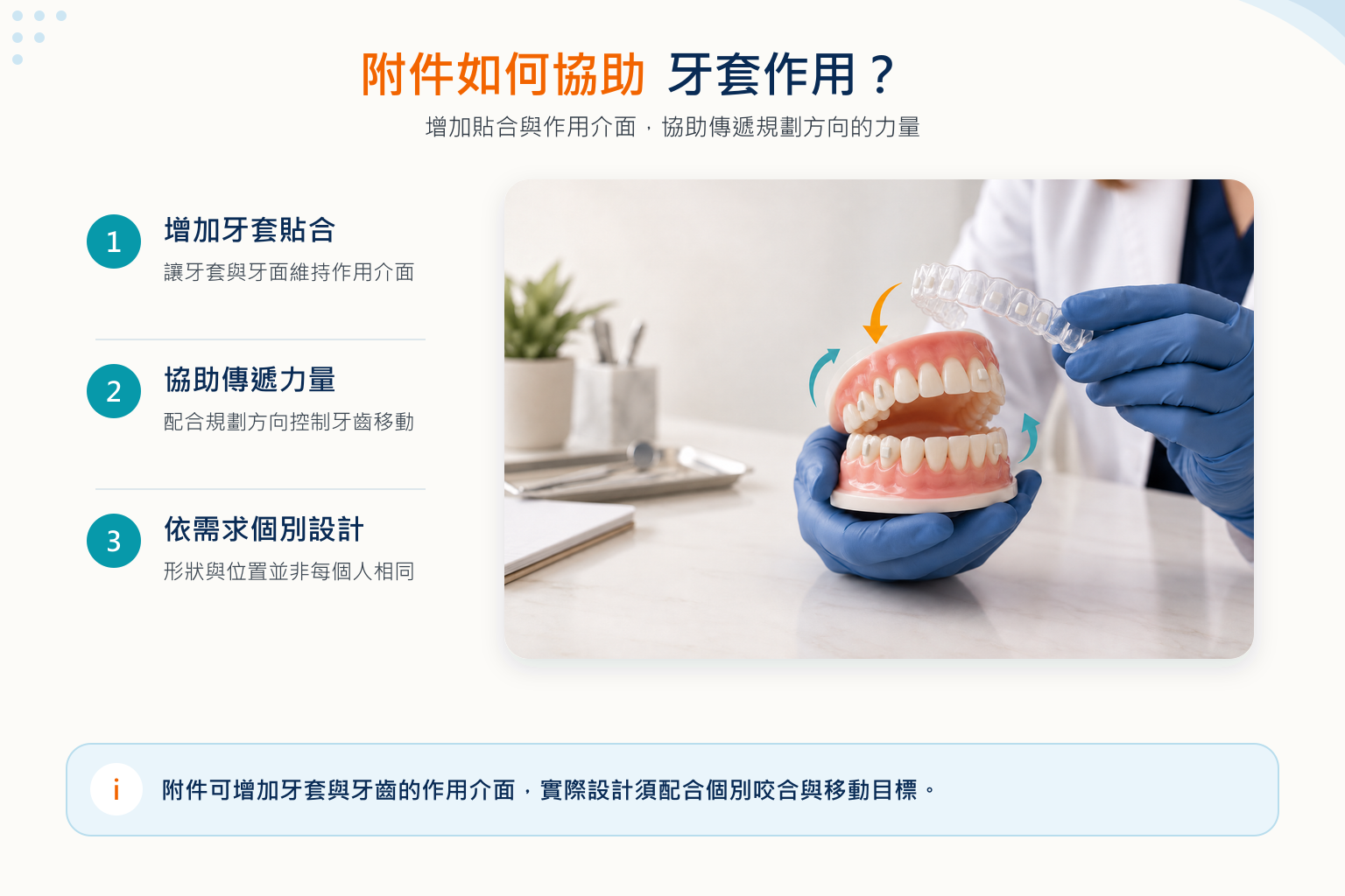 隱形牙套附件可協助牙套貼合並傳遞特定方向的力量