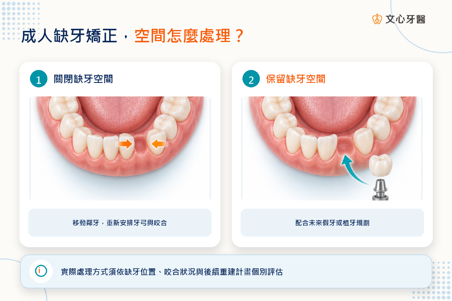 成人缺牙矯正可評估關閉空間或保留空間配合假牙植牙